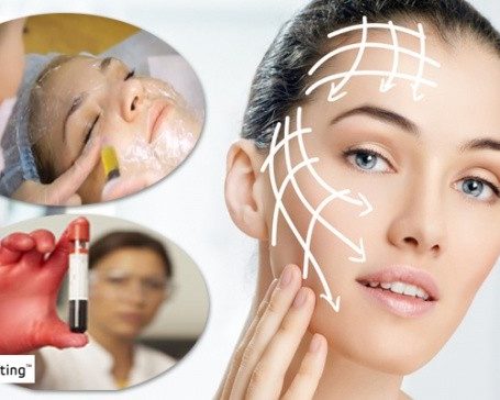Plasmolifting-gel