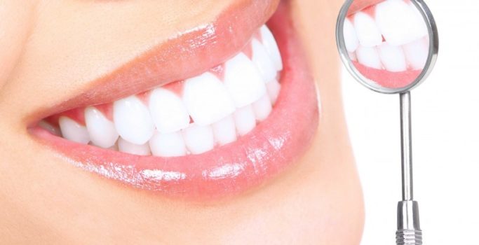 teeth-whitening3-820×420