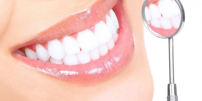teeth-whitening3-820×420